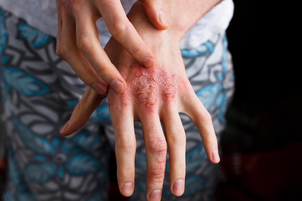 Stock photos: Ternavskaia Olga Alibec/Shutterstock.com