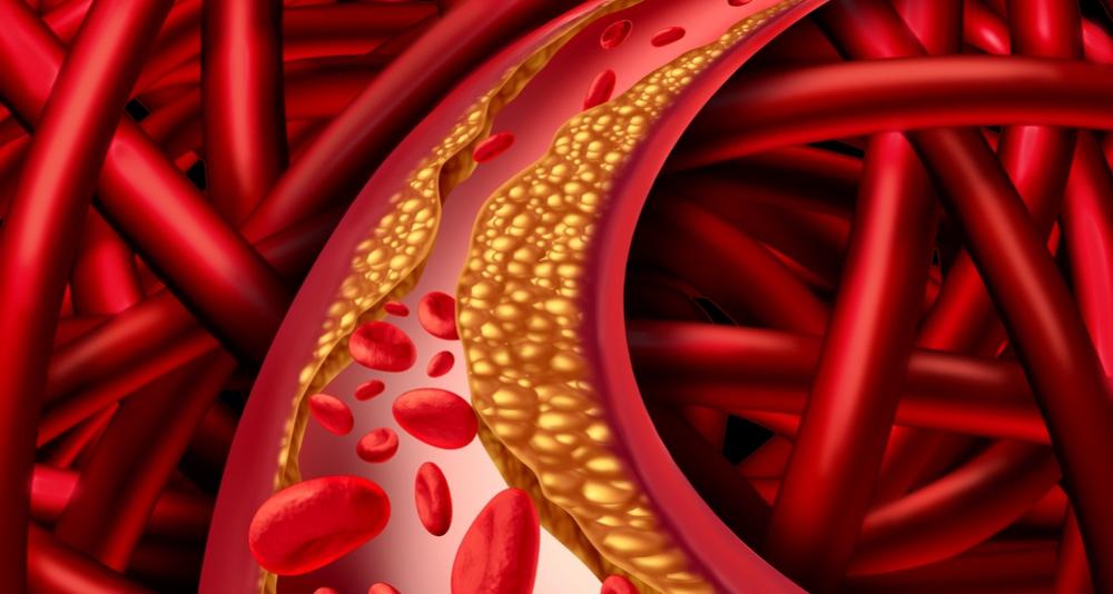 Cholesterol a tuky – znáte svoje hodnoty?